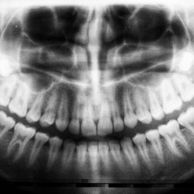 Curso de acreditación de Operador de Radiodiagnóstico Dental