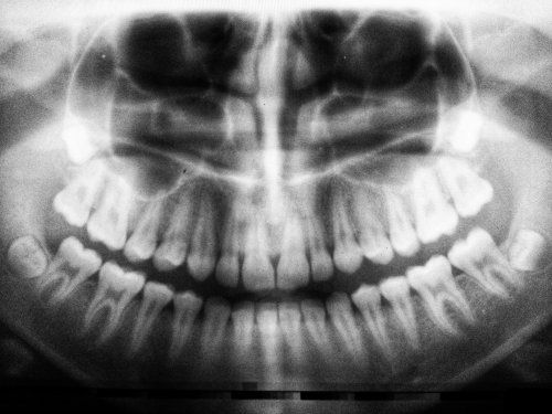 Curso de acreditación de Operador de Radiodiagnóstico Dental