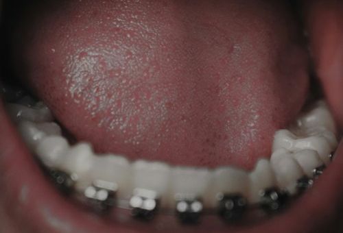 ¿Sabías qué un mal aliento puede ser señal de un problema bucal?