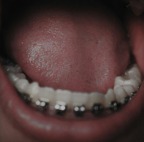 ¿Sabías qué un mal aliento puede ser señal de un problema bucal?